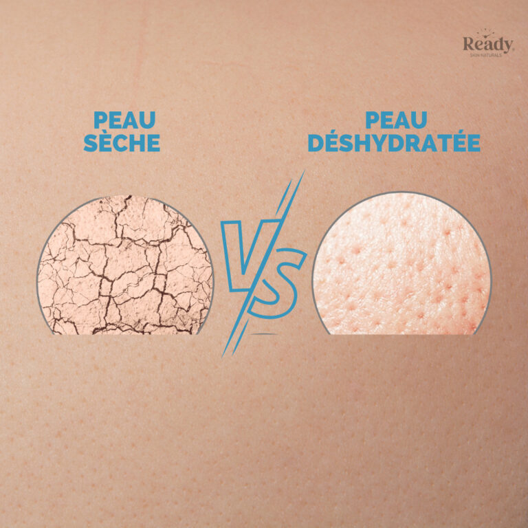 Lire la suite à propos de l’article Peau sèche VS peau déshydratée : quelle est la différence ?