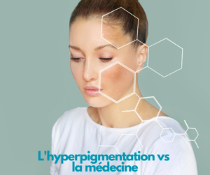 Hyperpigmentation vs médecine